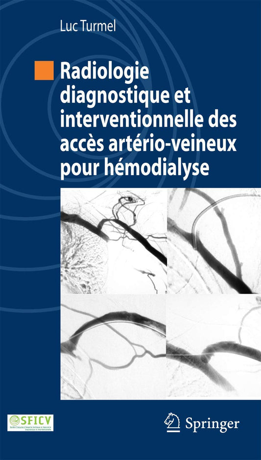 Radiologie diagnostique et interventionnelle des accès artério-veineux pour hémodialyse (Collection de la Société française d’imagerie cardiaque et vasculaire) (French Edition) 2012th Edition French Edition  by LUC TURMEL